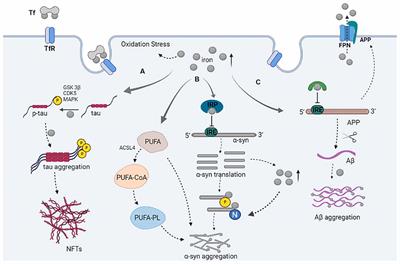 Parkinson’s Disease Dementia: Synergistic Effects of Alpha-Synuclein, Tau, Beta-Amyloid, and Iron